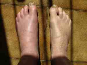 Is this what your foot likes like?