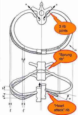 Sharp pain in the midback is often caused by a subluxated rib head. 