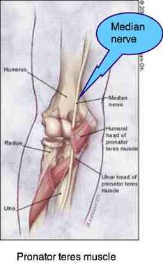 The pronator teres can cause severe pain radiating down the lower arm to the fingers.
