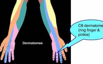 Which fingers tingle in your right arm?