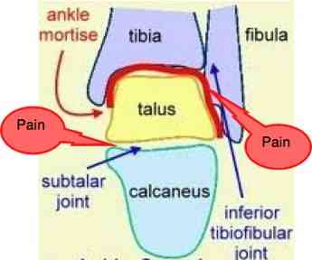 ankle mortise and subtalar joints.