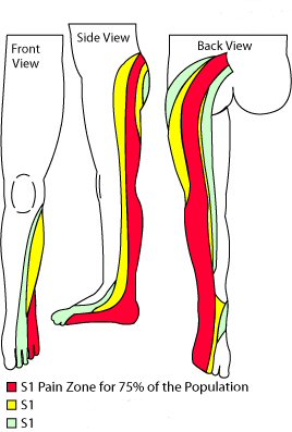 Superficial tingling numbness and coldness in lower legs