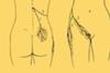 Burning tingling in feet and sometimes in hands along with ...