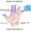 The median nerve is sometimes tethered in the elbow or wrist.