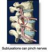 Chiropractic subluxation