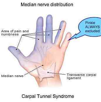 The little finger is always excluded in carpal tunnel.