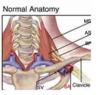 Thoracic outlet - artery and brachial plexus pass through the gap. 