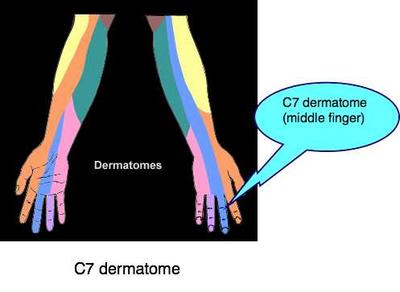 c7 dermatome
