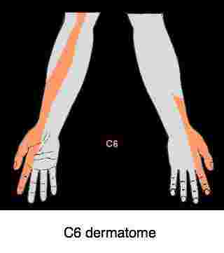 C6 dermatome