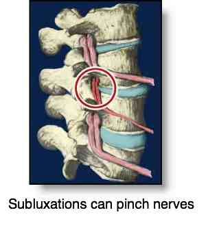 Chiropractic subluxation