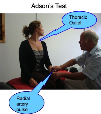Adson's test