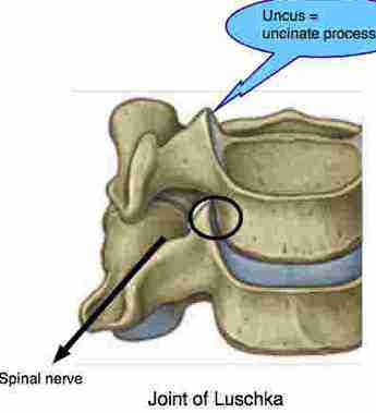 Uncovertebral = joint of Luschka