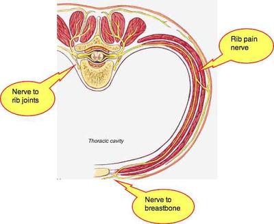Rib pain: sometimes midback, sometimes also breastbone. 