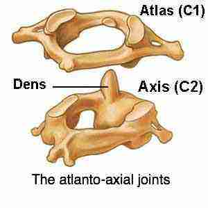 atlantoaxial joint