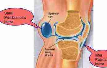 Bakers cyst knee can cause very sharp pain behind the leg.