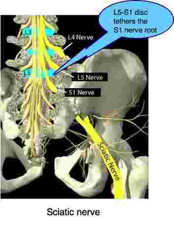 Lower back and leg pain is the most common complaint in our clinics.