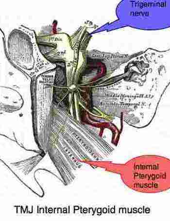 tmj tinnitus pterygoid