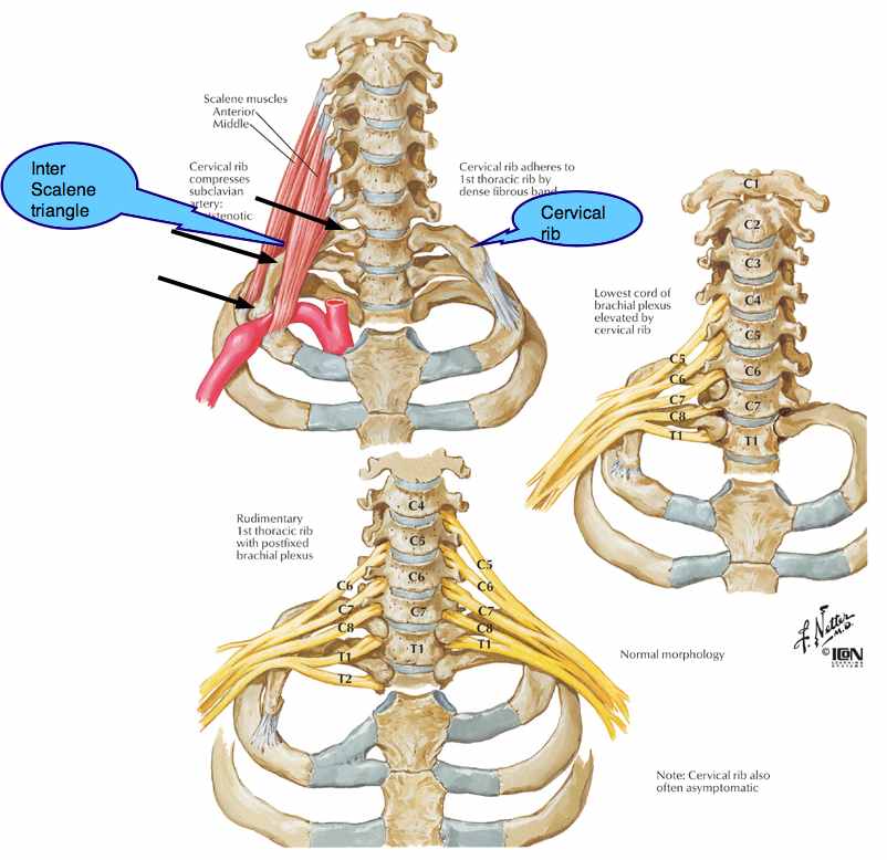 CHIROPRACTIC HELP #32: Rib pain